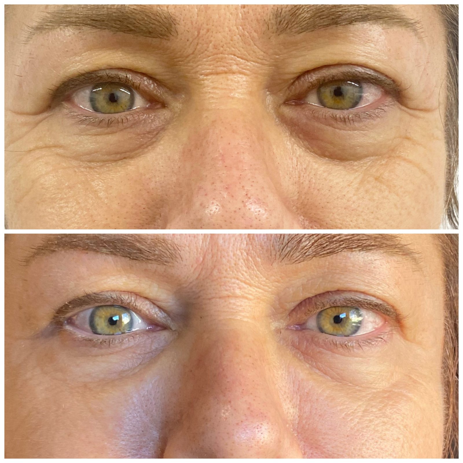 Treatment Gallery | Aesthetic Treatments in Enfield, North London