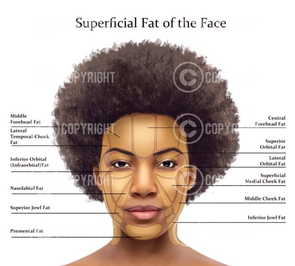 Superficial Fat Pads of the Face Lisa Digital Download