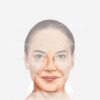 Bundle | Ageing of the Face and Neck Giorgia Digital Download