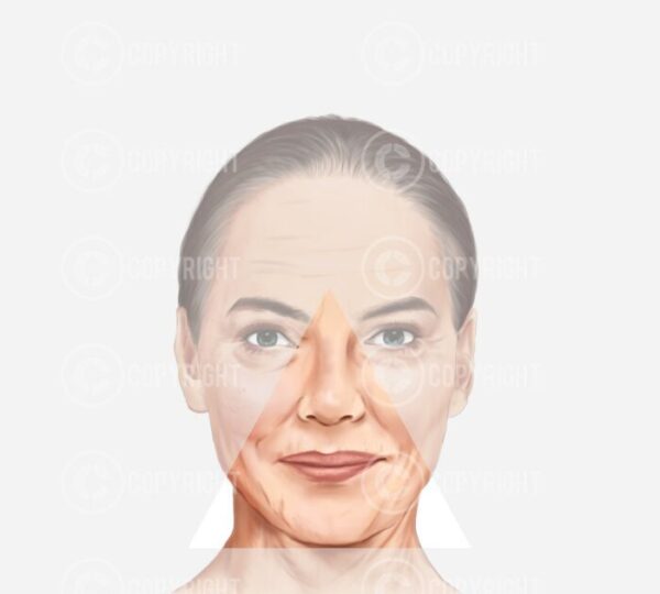 Bundle | Ageing of the Face and Neck Giorgia Digital Download