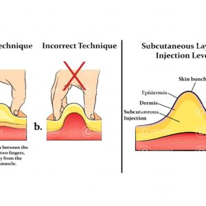 Subcutaneous injection technique Digital Download